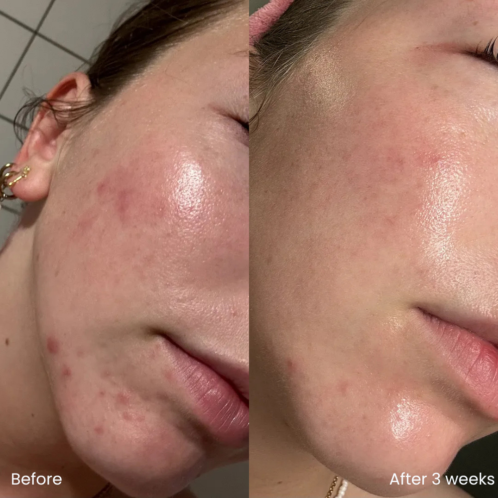 Barrier repair serum