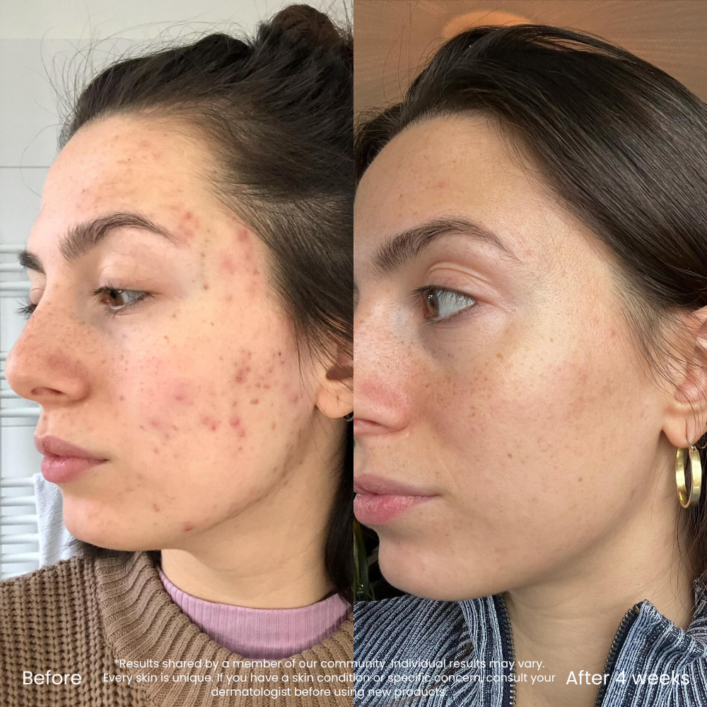 Dark Spot & Redness Correcting Vitamin C Serum