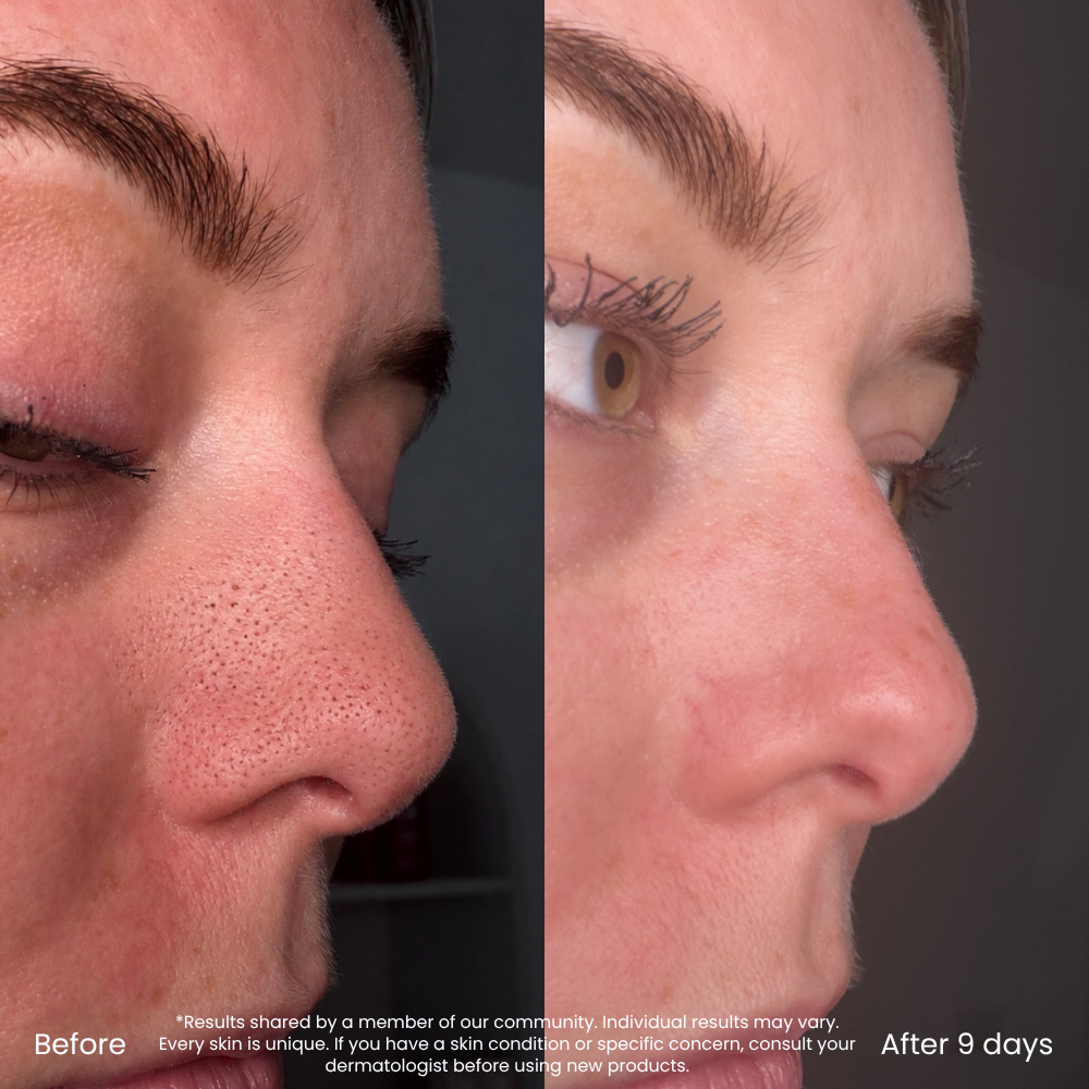 Masque à L'argile Rose