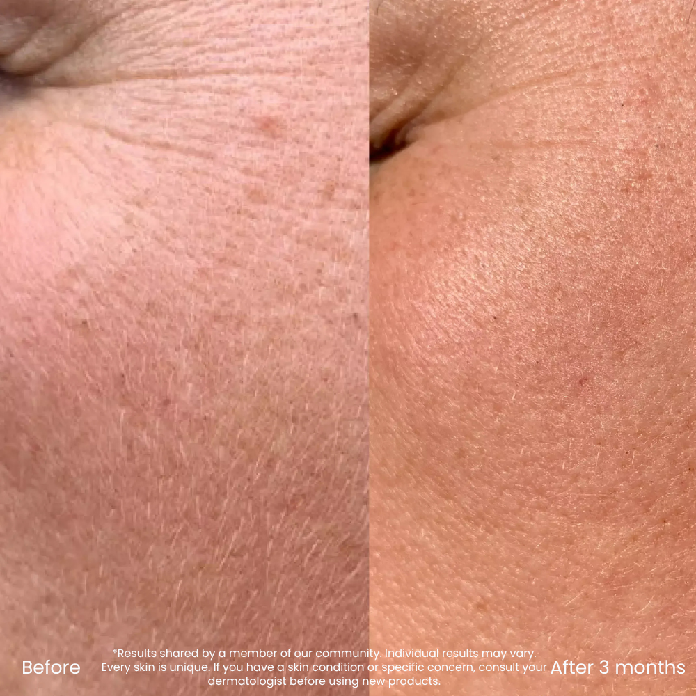 0.3% Retinol Serum For Fine Lines & Uneven Texture