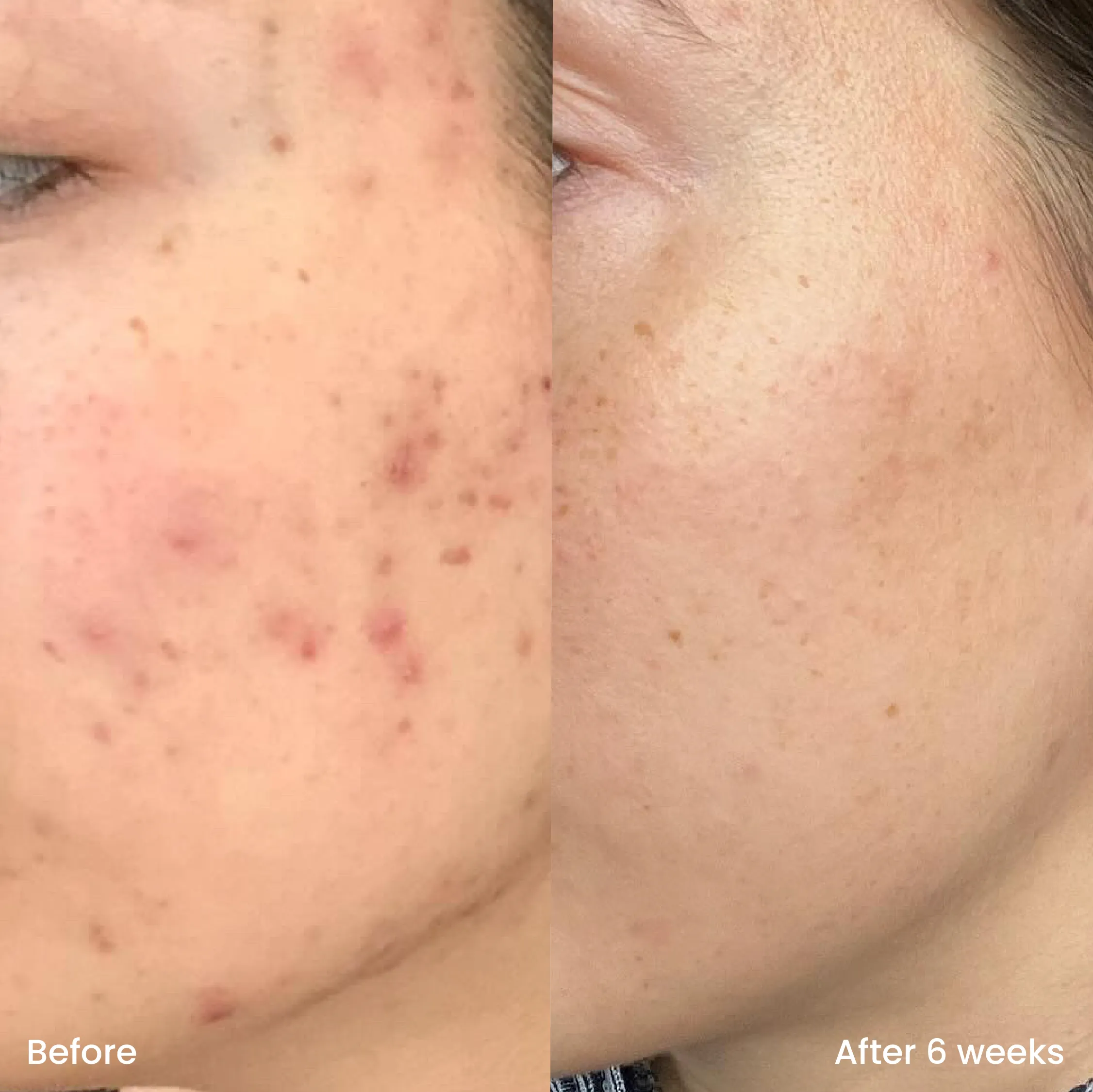Gommage Visage Exfoliant | 100ml