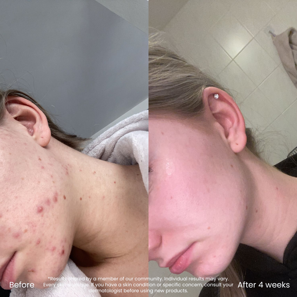 Niacinamide Clear Skin Serum