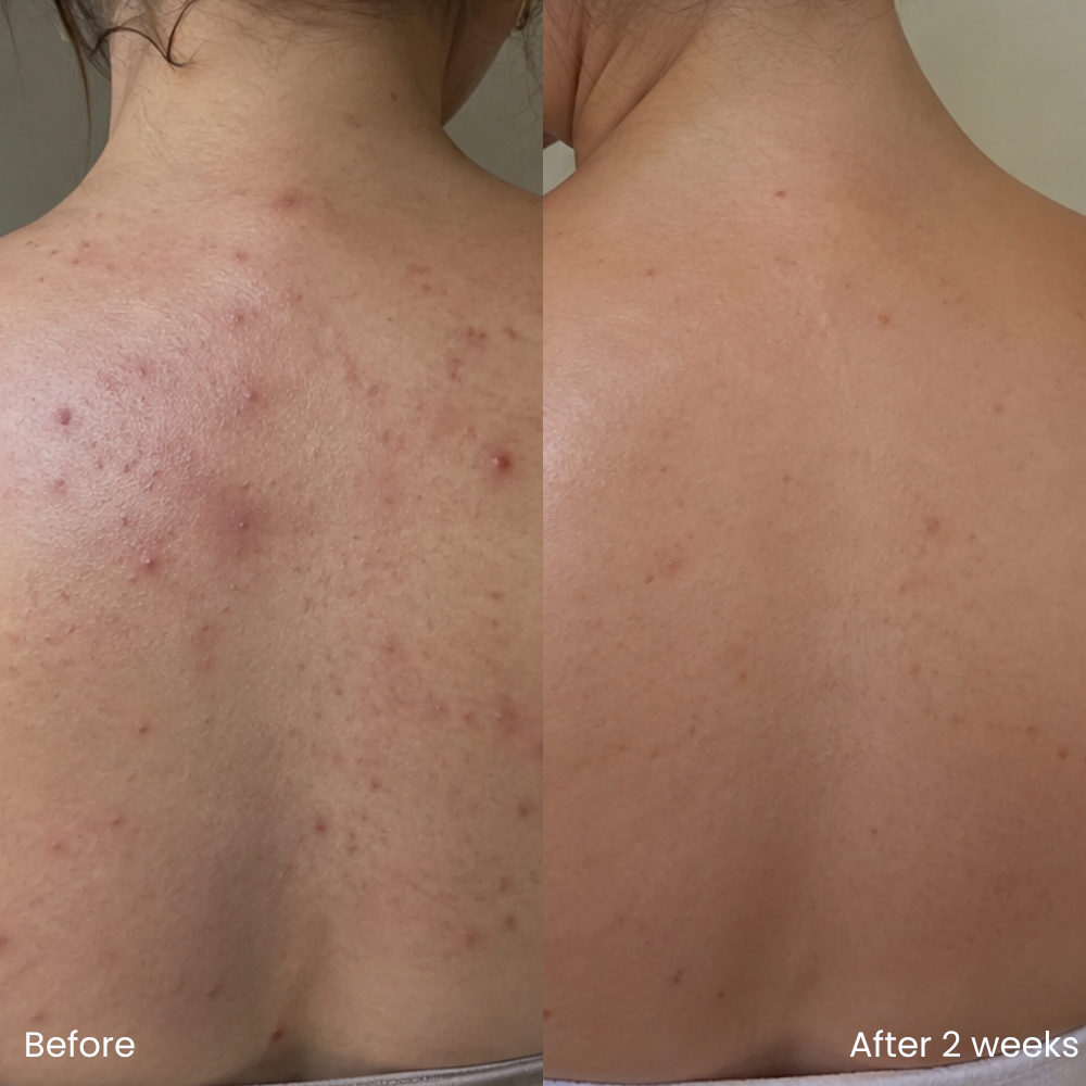 Hydrating body lotion