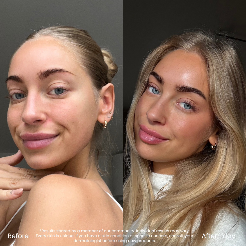 Hyaluronic Acid Self Tan Drops For A Natural Glow