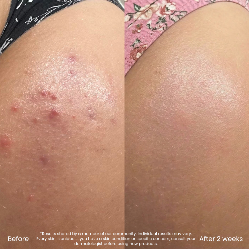 Hyaluronic Acid Hydrating Body Lotion