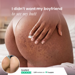 Soothing Body Lotion For Butt Pimples And Bumps